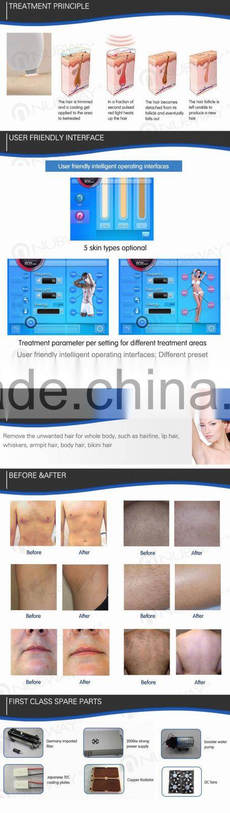 Totally painless treatment diode laser hair removal 808nm machine with 10 layer Germany DILAS laser bar
