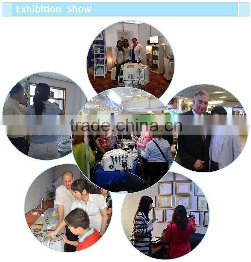 2016 Distributors wanted 1500mj medical eo active q switched nd yag with CE