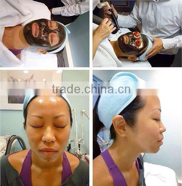Big energy Q-switch Nd yag laser laser stretch mark removal machine