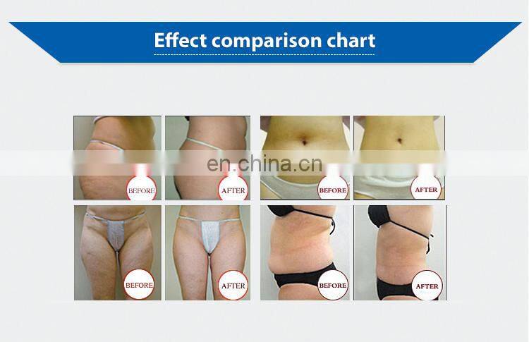 Professional Weight Loss Slimming Cavitation Vacuum Fat Reduction Slimming Machine