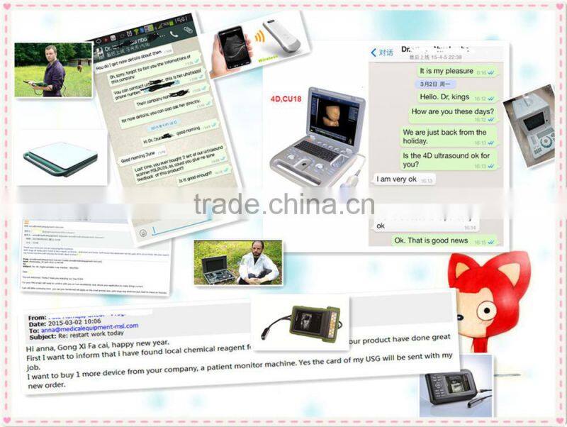 Portable Ultrasound Machine CU18A Made by Latest Color Ultrasoun Technology