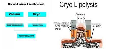 2015 hot seller--criolipolisis machine freeze fat for body slimming