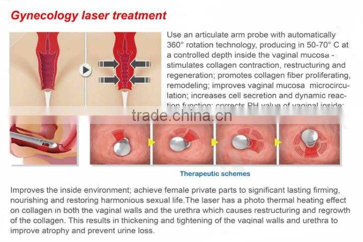 JMSHR Salon/Hospital Use 30W Korea Import Arm CO2 Fractional Laser RF Tube For Eyebrow Lid Removal