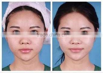 Newest oxygen skin rejuvenation ,pores removal and tightening skin machine for salon and clinic