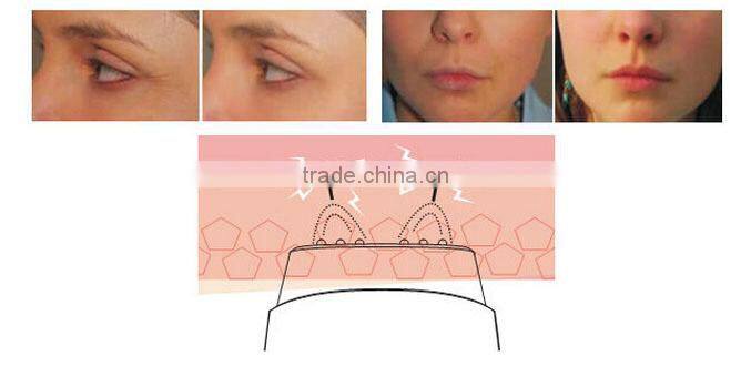 radio frecuencia portatil facial lifting RF equipment