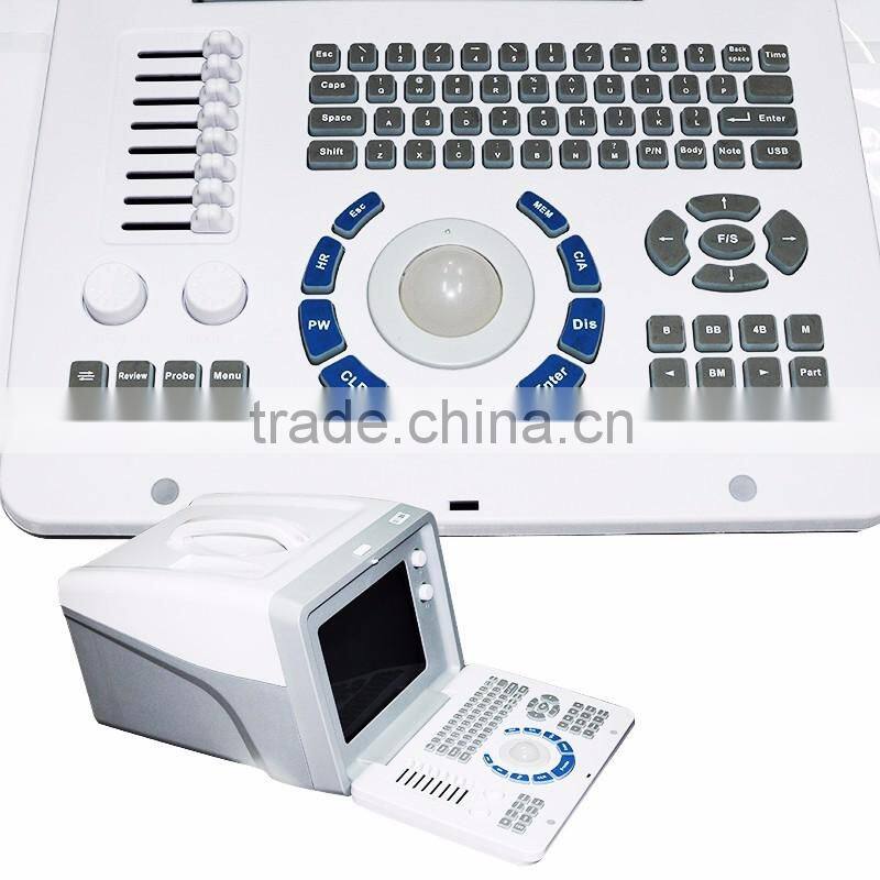 CE Approved full digital LCD display diagnostic laptop ultrasound scanner