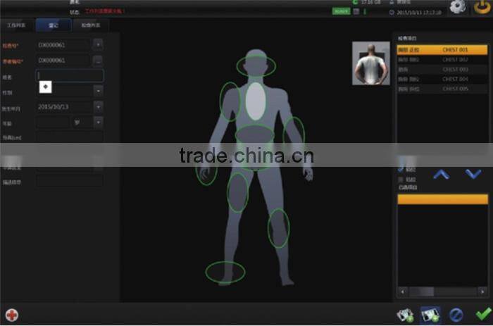 wired or wireless High resolution flat panel detector for sale