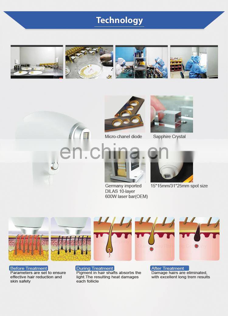 High Speed Sliding laser diode 808nm/808nm diode laser hair removal Pigment Removal Skin Rejuvenation machine with cheap price