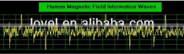 Popular Quantum Magnetic Resonance with TENS therapy