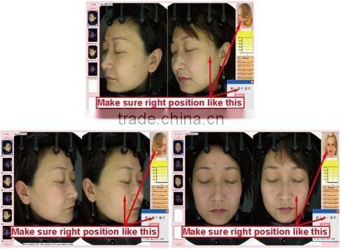 hot sell magic mirror facial skin analyzer / 3d face camera