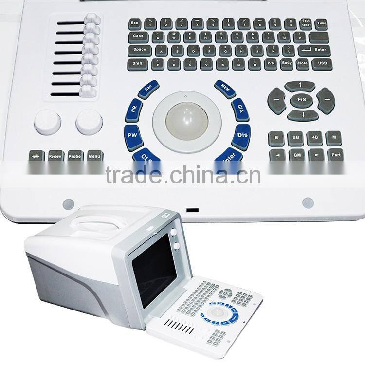 High Quality Ultrasound Machine Medical equipment ultrasound machine portable
