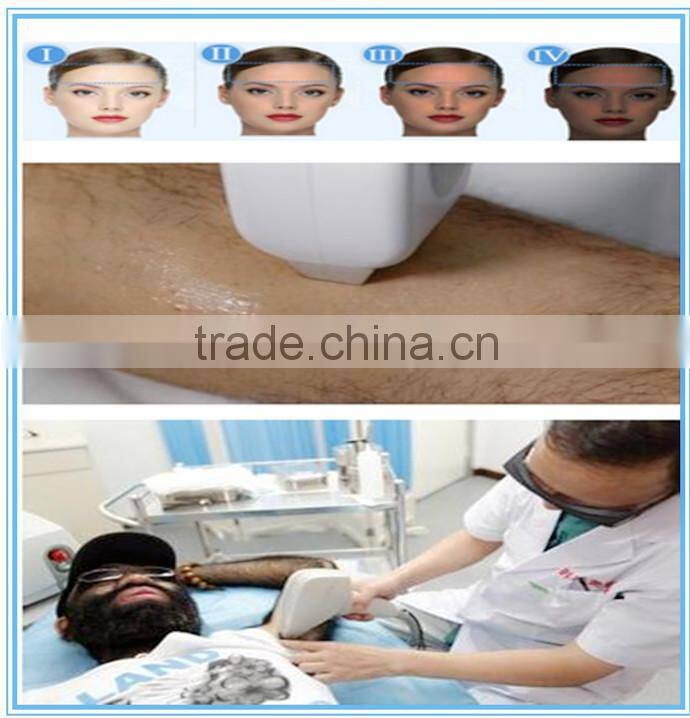 Alibaba express diode laser hair removal germany