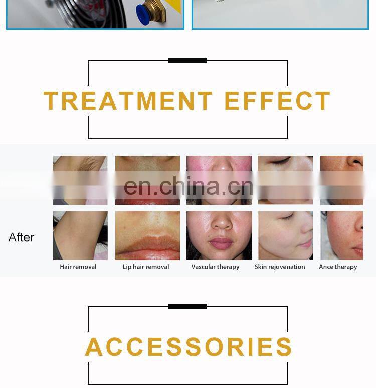 2020 Effective beauty products ipl elight acne therapy opt shr hair removal painless machine