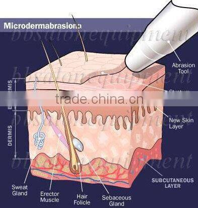 1031-146(Manufacturer) exfoliating body scrubber diamond replacement skin microdermabrasion machine