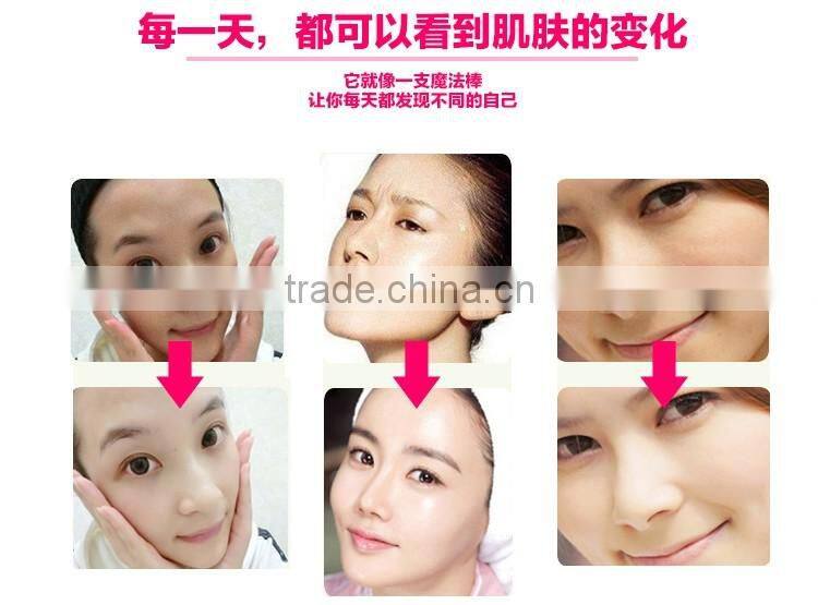 Sonic Peelling Ultrasonic Skin Scrubber Spatula & Infusion Face massage and skinyang portable Sonic peeler skin scrubber