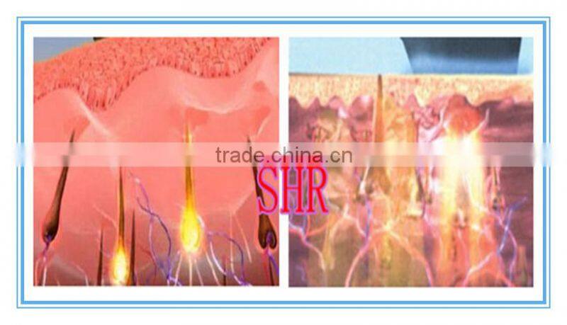 IPL SHR laser hair removal machine with touch screen