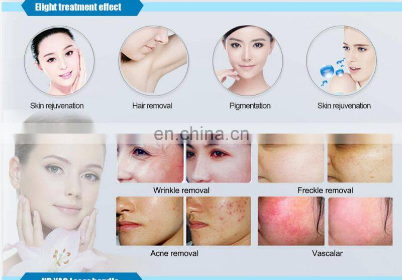 6-in-1 body slimming machine& beautifying machine cavitation+Vacuum+Rf