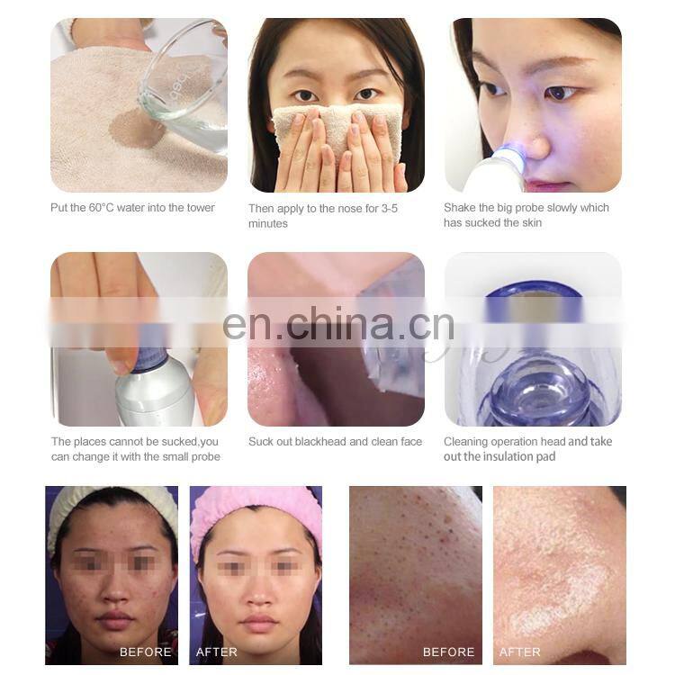 Vacuum Pore Cleaner Vacuum Blackhead Remover Blackhead Suction Machine Comedo Microdermabrasion Face Pore Cleaning