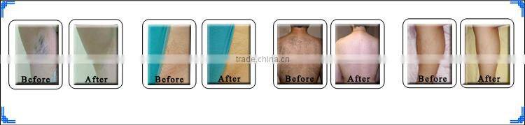 vertical type SHR/ IPL beauty machine, IPL hair removal machine