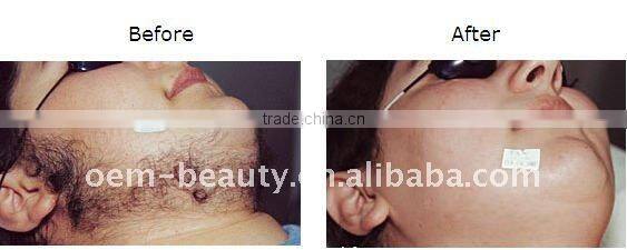 Multi-function hair removing electric skin tensing beauty machine C009