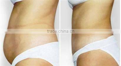 40kHz ultrasonic probe+LED light therapy+motor roller therapeutic ultrasound cellulite reduction Machine F002