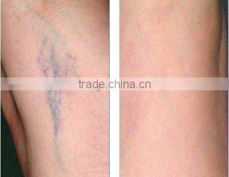 C001 Flexible touch screen ipl rf e-light hair depilation