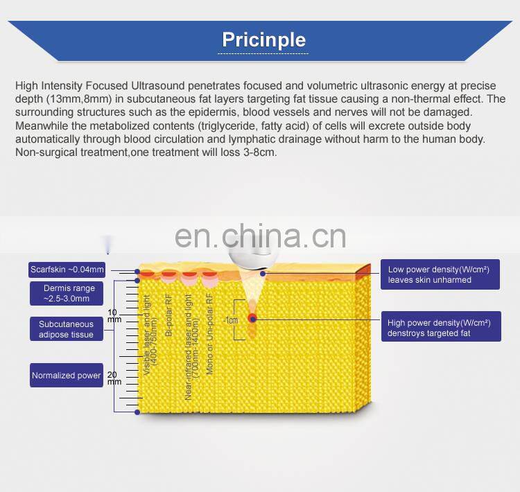 airsculpt reduct fat hifu fat removal liposonic machine