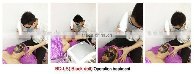 laser tattoo removal machine with competitive price