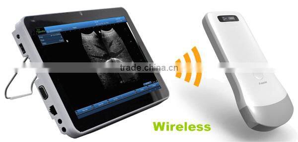 Mobile phone type ultrasound scanner