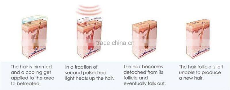 diode laser nono hair removal machine with CE