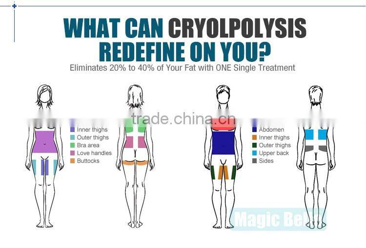 CE Certificated Multipolar RF Skin Wrinkle Removal Machine Cool Cryo Shape Slimming Machine from China