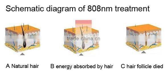 Diode laser 808 nm machine for personal care & hair removal & face liftup beauty equipment