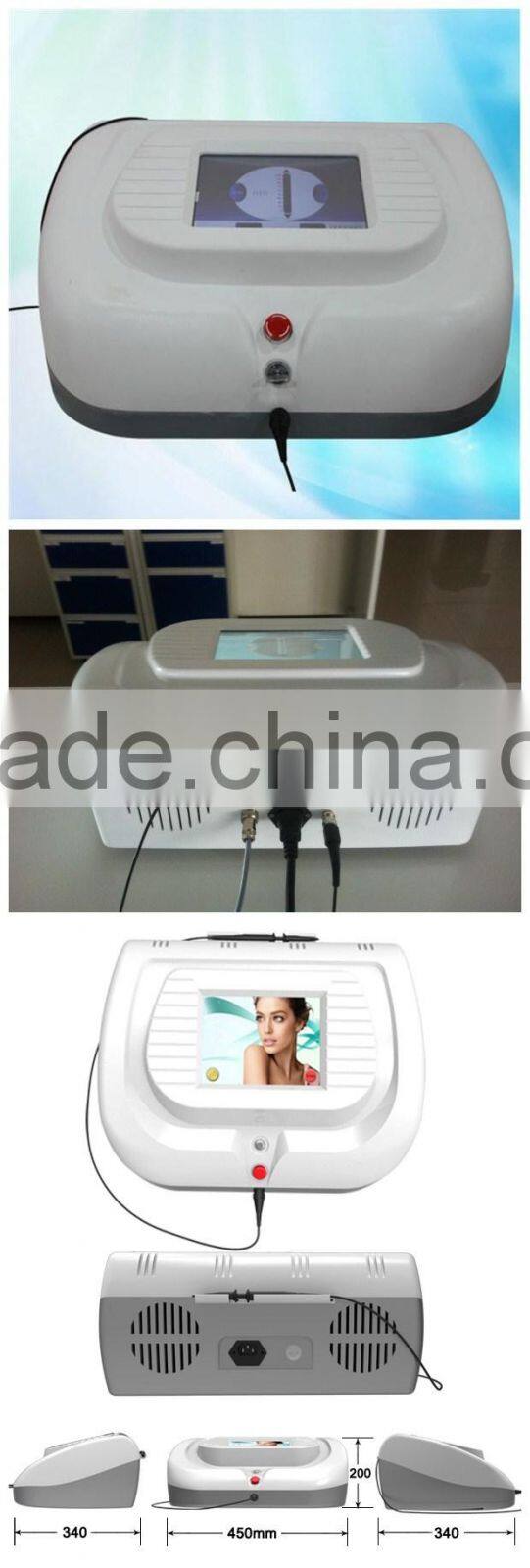 Hot selling ! Vascular Lesions /Spider Veins / Facial Laser Veins Removal