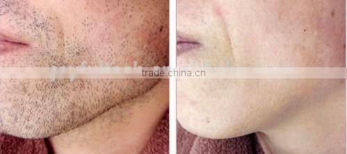 Hair salon equipment diode laser 808nm hair removal machine