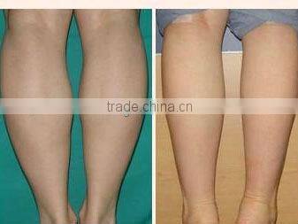 Professional No scar,no pain 40KHz Strong Ultrasound weight loss machine-F002 for fat loss on sale from China CE Approve