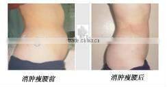 Diode Lipo Laser slimming machine