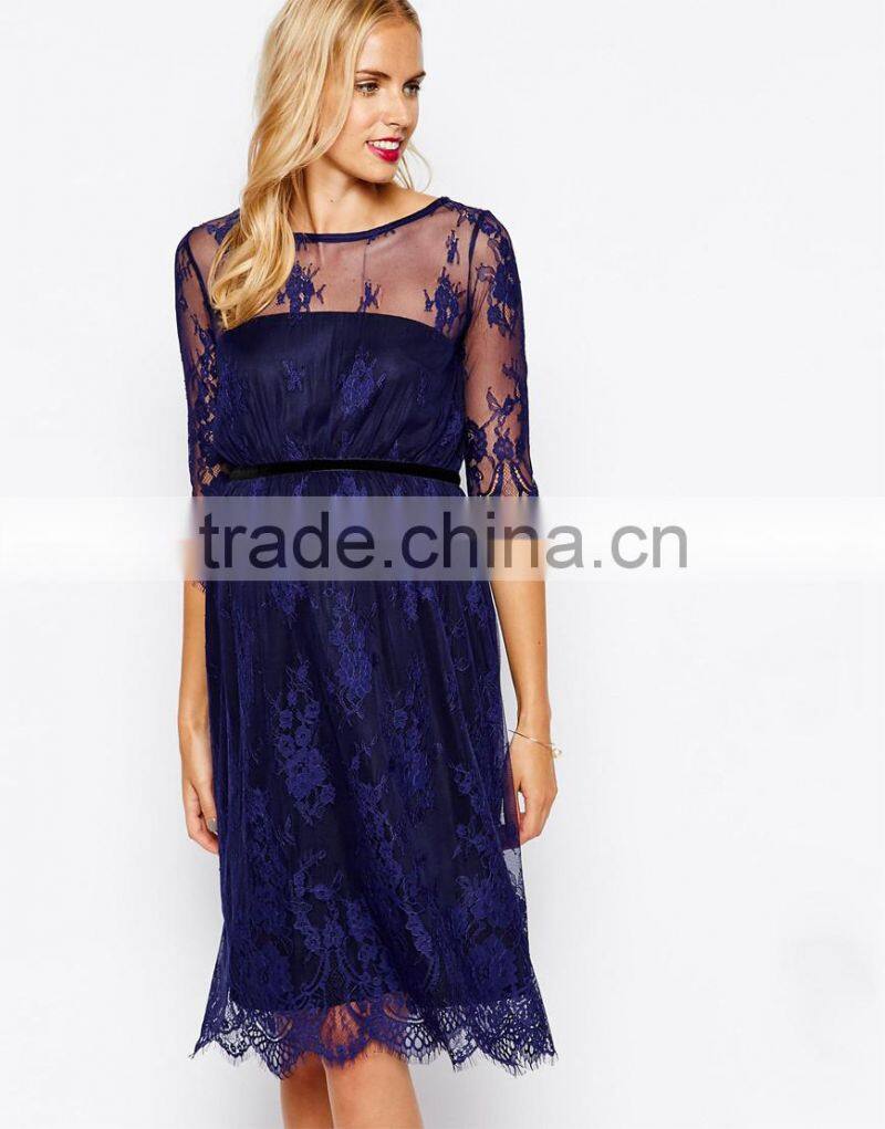 Maternity Lace Midi Dress With Scalloped Detail