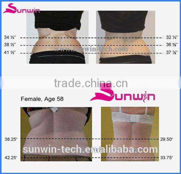 Best Cellulite fat removal machine with multi languages system