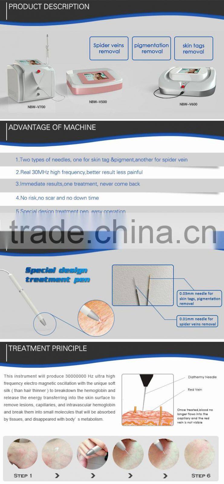 2016 Hot Distributor Wanted High Quality Laser Vascular Spider Vein Removal/Varicose Vein Removal Machine Price For Sale