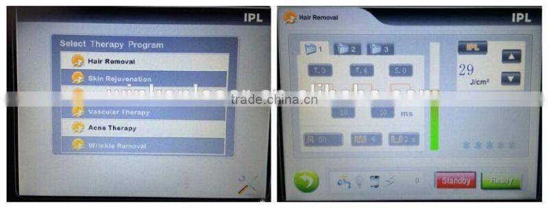 lazer epilation / laser machine