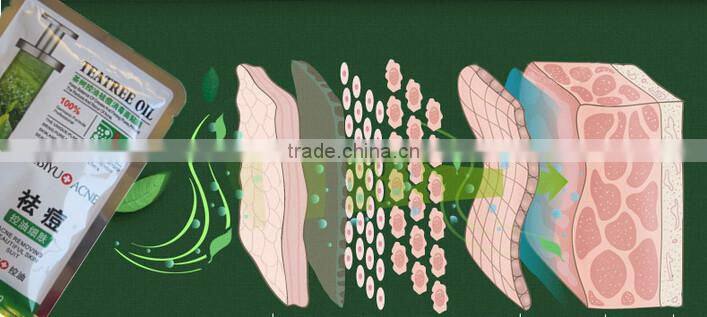 Acne treatment products skin care natural tea tree oil effective anti-acne face mask