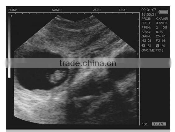 Handheld mobile ultrasound/Veterinary Ultrasound scanner CE, FDA, ISO certification approved/vet ultrasound scaner M50