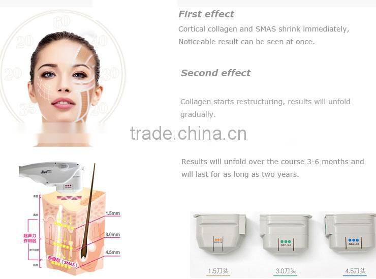 Ten years yonger high intensity focused ultrasound for wrinkle removal,anti-aging,skin lifting