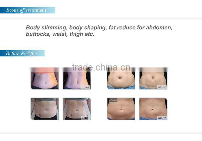 2015 new design portable HIFUSHAPE slimming beauty device high intensity focused ultrasound hifu