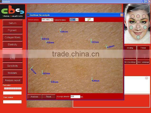 2015 Latest 3D Skin Analyzer/ Skin Analyser(English version software)