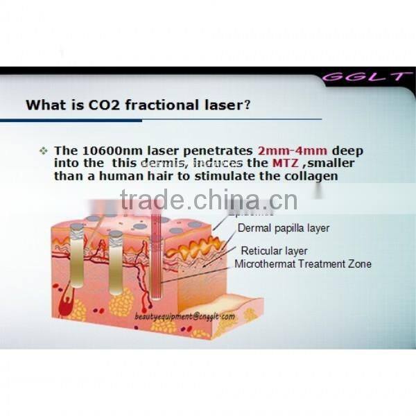 Scar/Wart/Acne Removal Fractional CO2 Laser
