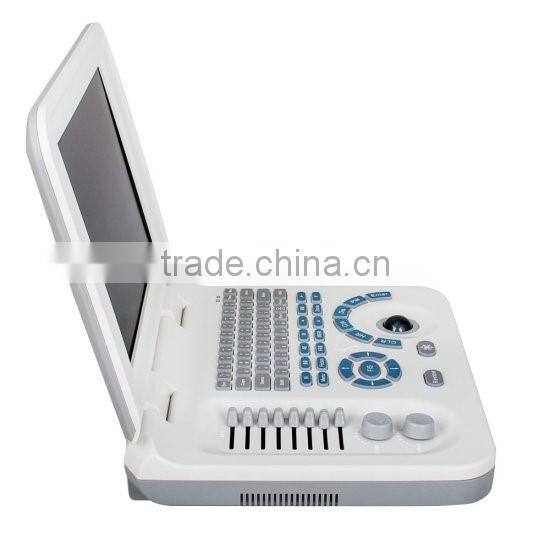 Full Digital Laptop B&W ultrasound system Ultrasound Scanner Ultrasound machine