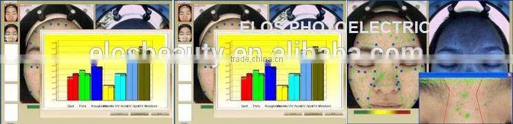 Professional Skin Analyzer Machine, skin test machine