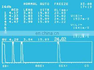 ODM-1000A/P Ultrasonic A Biometer & Pachymeter