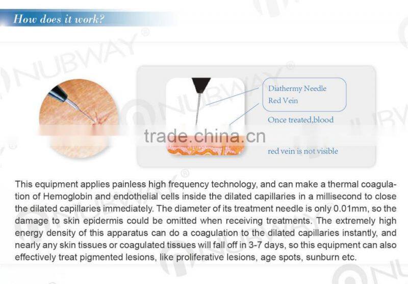 Promotion! Electrolysis Blend Machine telangiectasia for vein removal